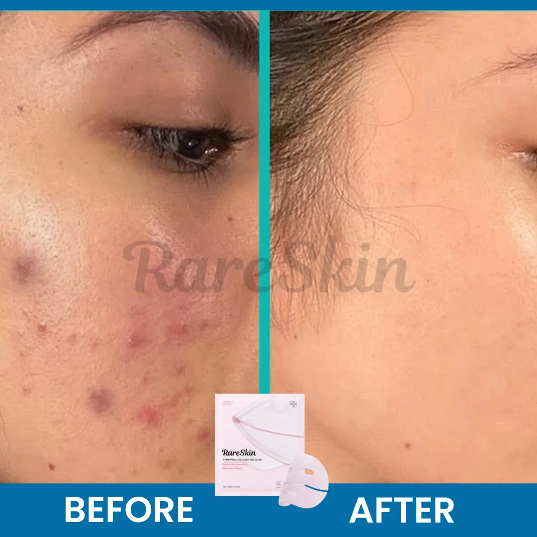 The Salmon PDRN Pink Collagen Face Mask